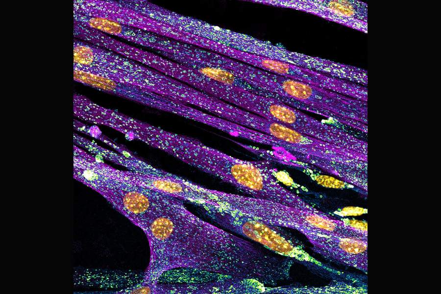 Nikon Small World 2022