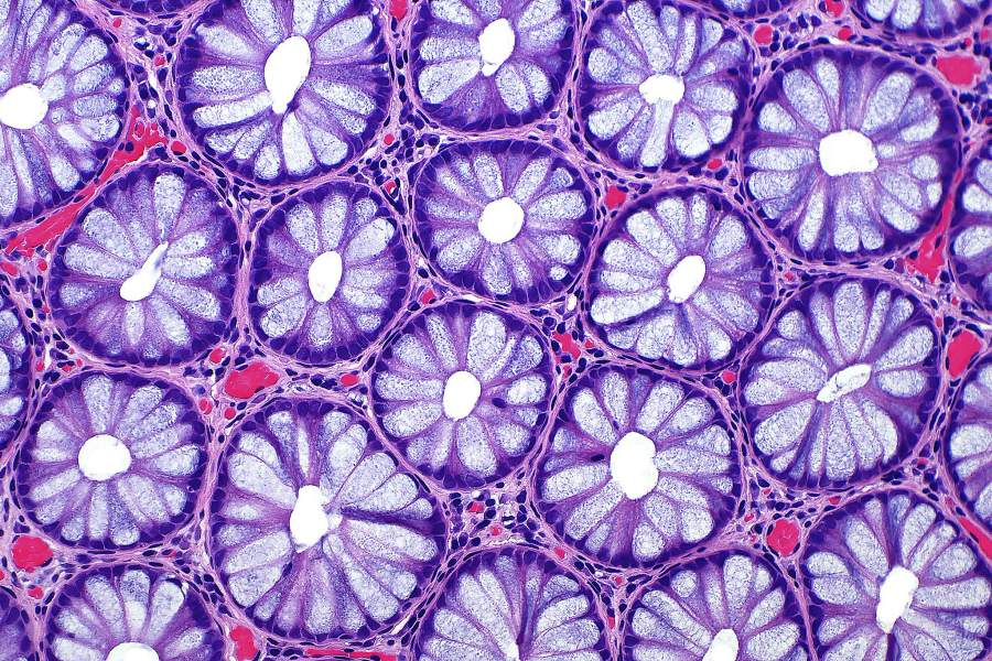 Nikon Small World 2022