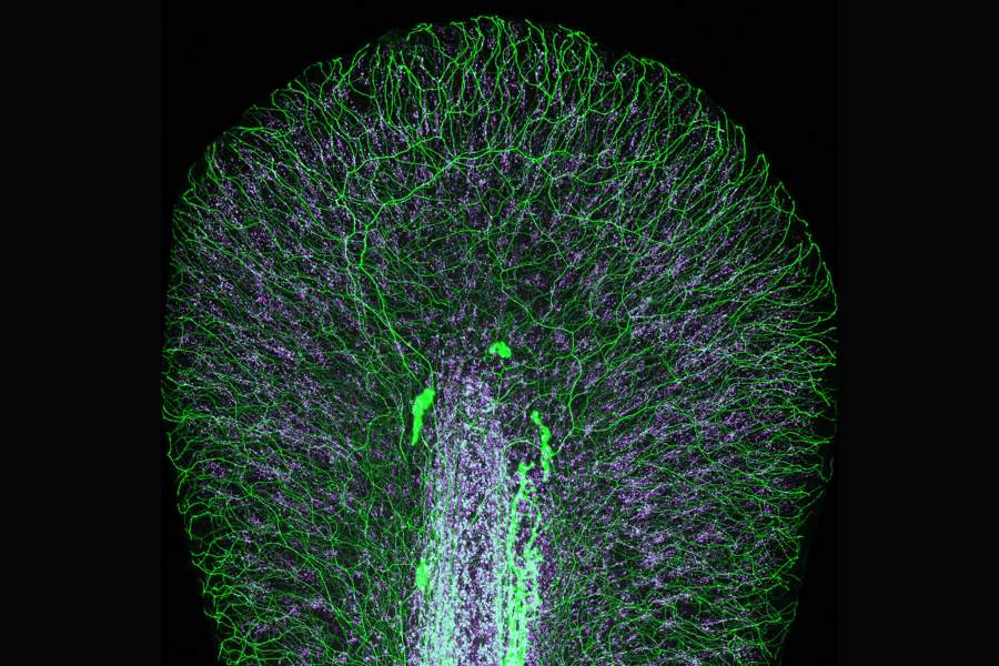 Nikon Small World 2022