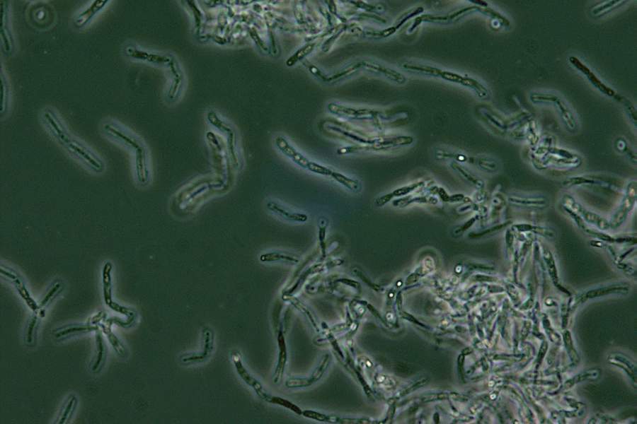 Споры сибирской язвы при фазово-контрастной микроскопии