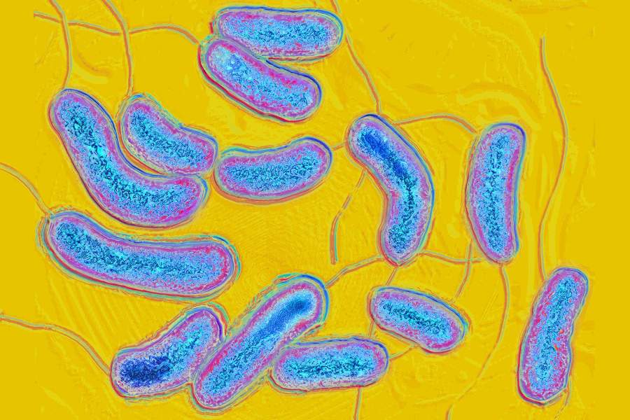 Вибрионы холеры под микроскопом