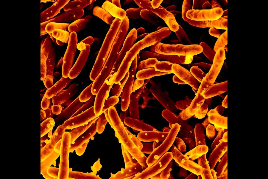Mycobacterium tuberculosis-туберкулезная палочка