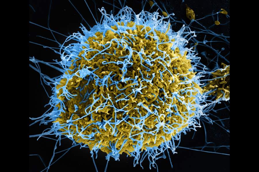 Раскрашенная сканирующая электронная микрофотография нитевидных частиц вируса Эбола